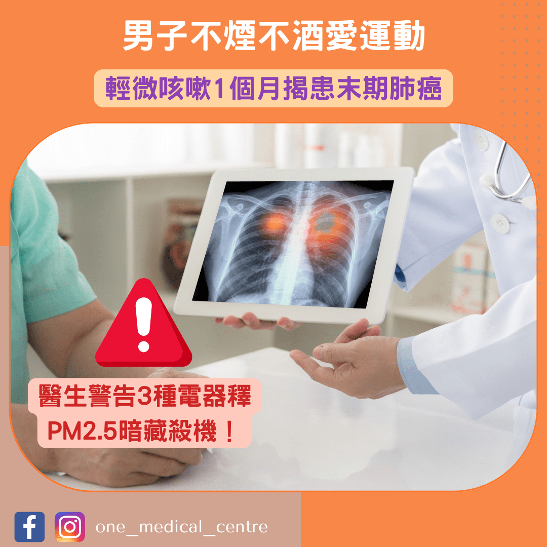 【男子不煙不酒愛運動　輕微咳嗽1個月揭患末期肺癌　醫生警告3種電器釋PM2.5暗藏殺機】